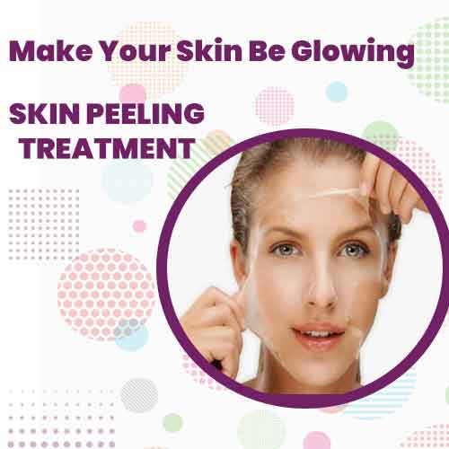 SKIN PEELING TREATMENT